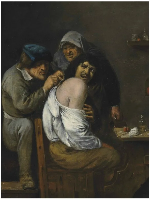Joos van Craesbeeck: English: An interior with a doctor treating a patient