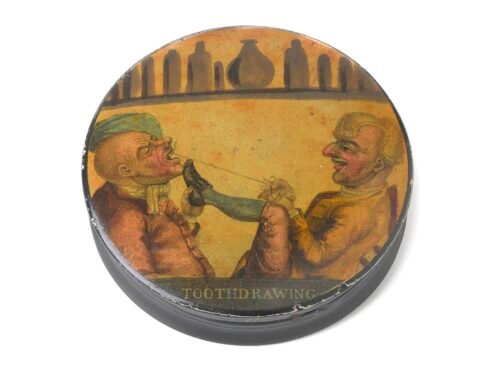 Wooden snuff box, cylindrical, lacquered and printed on the top with a scene of a dentist extracting a tooth, 1701-1900. A painful tooth extraction is shown on the lid of this snuff box. A piece of string has been secured around the patient’s tooth and is being pulled by the dentist who is using his foot to brace himself against the patient’s jaw. The patient probably only had, at best, alcohol or herbal concoctions to relive the pain. Tooth pulling was carried out by a range of people including barber-surgeons and travelling practitioners, who often had limited medical skills at best. The illustration would suggest that the process was viewed as somewhat humorous – although not, presumably, by the patient.